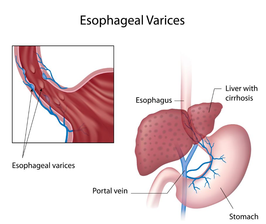 Cardiology